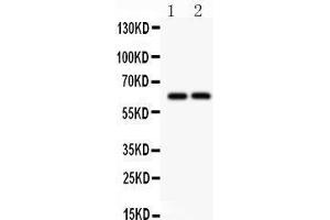 Anti- SLC22A2 Picoband antibody, Western blotting All lanes: Anti SLC22A2  at 0. (SLC22A2 antibody  (Middle Region))