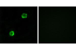 Peptide - +Immunofluorescence analysis of MCF-7cells, using APOL2 antibody. (Apolipoprotein L 2 antibody)