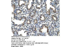Human Lung (SLC37A3 antibody  (Middle Region))