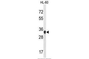 Western blot analysis of ATP5C1 Antibody (N-term) in HL-60 cell line lysates (35µg/lane). (ATP Synthase Subunit gamma (AtpC) (AA 46-76), (N-Term), (Subunit gamma) antibody)