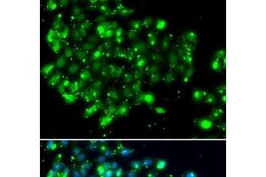 Immunofluorescence analysis of MCF-7 cells using NAT9 Polyclonal Antibody (NAT9 antibody)