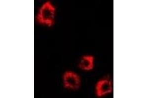 Immunofluorescent analysis of DDX58 staining in HepG2 cells. (DDX58 antibody)