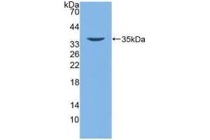 Detection of Recombinant DEFb2, Human using Polyclonal Antibody to Defensin Beta 2 (DEFb2) (beta 2 Defensin antibody  (AA 24-64))