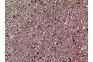 Immunohistochemical analysis of paraffin-embedded human-brain, antibody was diluted at 1:100.