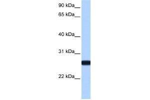 WB Suggested Anti-IL13RA2 Antibody Titration: 0. (IL13RA2 antibody  (N-Term))