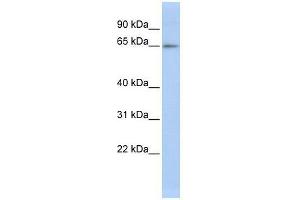 Western Blot showing ZNF619 antibody used at a concentration of 1-2 ug/ml to detect its target protein.