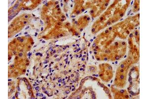 IHC image of ABIN7157473 diluted at 1:500 and staining in paraffin-embedded human kidney tissue performed on a Leica BondTM system. (CRYM antibody  (AA 169-258))