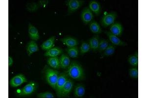 Immunofluorescent analysis of A549 cells using ABIN7142715 at dilution of 1:100