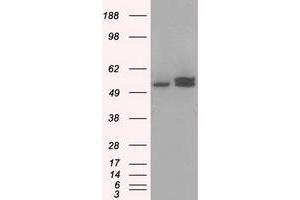 HEK293T cells were transfected with the pCMV6-ENTRY control (Left lane) or pCMV6-ENTRY ATP5B (Right lane) cDNA for 48 hrs and lysed. (ATP5B antibody)