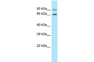 WB Suggested Anti-PALMD Antibody Titration: 1. (PALMD antibody  (N-Term))
