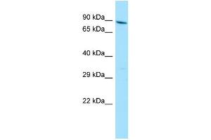 WB Suggested Anti-YTHDC1 Antibody Titration: 1. (YTHDC1 antibody  (N-Term))
