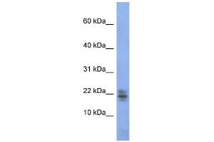 WB Suggested Anti-RNASE1 Antibody Titration:  0. (RNASE1 antibody  (Middle Region))