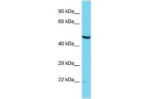 Host: Rabbit Target Name: DCAF12L2 Sample Type: Jurkat Whole Cell lysates Antibody Dilution: 1.