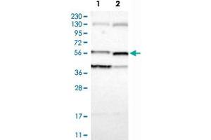Western Blot analysis of Lane 1: RT-4 and Lane 2: U-251MG sp cell lysates with VIL1 polyclonal antibody .