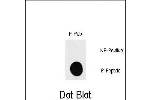 Dot blot analysis of anti-RPS6KB1-p Phospho-specific Pab (ABIN389748 and ABIN2839679) on nitrocellulose membrane.