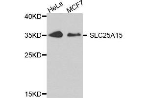Western blot analysis of extract of HeLa and MCF7 cells, using SLC25A15 antibody.