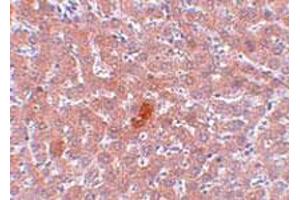 Immunohistochemical staining of rat liver tissue with 5 ug/mL KDM3A polyclonal antibody . (KDM3A antibody  (N-Term))