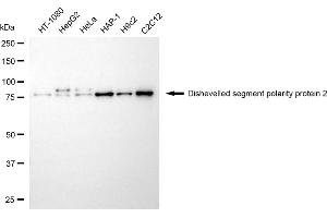 Western blotting analysis using dishevelled segment polarity protein 2 antibody (ABIN7798356).