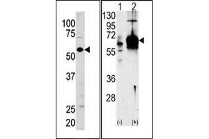 (LEFT)Western blot analysis of anti-GUCY1A3 Pab in mouse brain tissue lysate (35ug/lane).