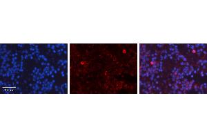 Rabbit Anti-TP53 Antibody   Formalin Fixed Paraffin Embedded Tissue: Human Lymph Node Tissue Observed Staining: Nucleus, Cytoplasm Primary Antibody Concentration: 1:100 Other Working Concentrations: 1:600 Secondary Antibody: Donkey anti-Rabbit-Cy3 Secondary Antibody Concentration: 1:200 Magnification: 20X Exposure Time: 0. (p53 antibody  (N-Term))
