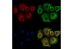 CCDC28A Antibody staining Hela cells by IF/ICC.