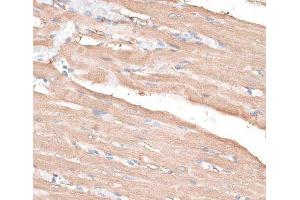 Immunohistochemistry of paraffin-embedded Rat heart using KIF14 Polyclonal Antibody at dilution of 1:100 (40x lens). (KIF14 antibody)