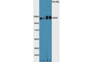 Lane 1: Mouse spleen lysate Lane 2: Mouse thymus lysate Lane 3: Mouse prostate lysate Lane 4: Mouse intestine lysate probed with Rabbit Anti-ASPP2/p53BP2 Polyclonal Antibody, Unconjugated (ABIN674394) at 1:300 overnight at 4 °C. (TP53BP2 antibody  (AA 1001-1128))