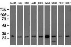 Western blot analysis of extracts (35 µg) from 9 different cell lines by using anti-OTUB2 monoclonal antibody. (OTUB2 antibody)