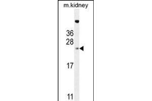 ADO Antibody (C-term) (ABIN655033 and ABIN2844665) western blot analysis in mouse kidney tissue lysates (35 μg/lane).