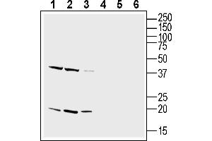 Western blot analysis of rat brain lysate (lanes 1 and 4), mouse brain lysate (lanes 2 and 5) and mouse liver lysate (lanes 3 and 6):1-3. (CD81 antibody  (Extracellular))