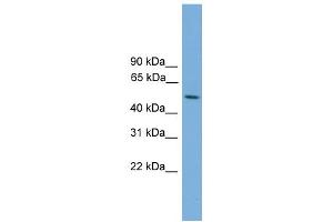 WB Suggested Anti-STK38L Antibody Titration: 0.