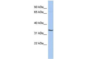 WB Suggested Anti-RNF113B Antibody Titration:  0.
