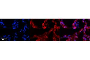 GPAA1 antibody - C-terminal region          Formalin Fixed Paraffin Embedded Tissue:  Human Lung Tissue    Observed Staining:  Cytoplasm of pneumocytes   Primary Antibody Concentration:  1:100    Other Working Concentrations:  1/600    Secondary Antibody:  Donkey anti-Rabbit-Cy3    Secondary Antibody Concentration:  1:200    Magnification:  20X    Exposure Time:  0. (GPAA1 antibody  (C-Term))