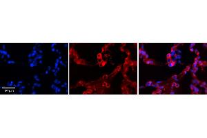 GPAA1 antibody - C-terminal region          Formalin Fixed Paraffin Embedded Tissue:  Human Lung Tissue    Observed Staining:  Cytoplasm of pneumocytes   Primary Antibody Concentration:  1:100    Other Working Concentrations:  1/600    Secondary Antibody:  Donkey anti-Rabbit-Cy3    Secondary Antibody Concentration:  1:200    Magnification:  20X    Exposure Time:  0.