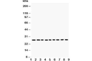 Western blot testing of Kallikrein 6 antibody and Lane 1:  MCF-7;  2: HeLa;  3: MM231;  4: MM453;  5: A549;  6: SMMC-7721;  7: COLO320;  8: SW620;  9: HT1080 (Kallikrein 6 antibody  (C-Term))