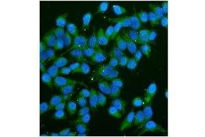 IF analysis of CD59 using anti-CD59 antibody (ABIN7600941). (CD59 antibody  (AA 26-102))
