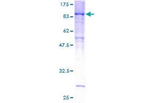 PPP2R5D Protein (AA 1-602) (GST tag)