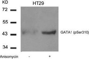 Image no. 2 for anti-GATA Binding Protein 1 (Globin Transcription Factor 1) (GATA1) (pSer310) antibody (ABIN196686)
