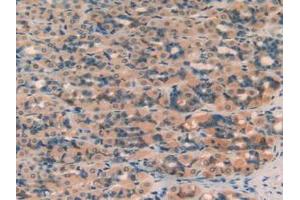 Figure. (SERPINA7 antibody  (AA 114-391))