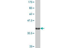 Western Blot detection against Immunogen (37. (Chloride Channel 5 antibody  (AA 566-665))