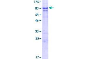 RMDN3 Protein (AA 1-470) (GST tag)