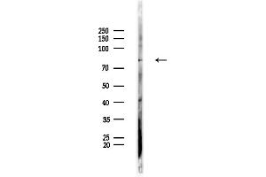 anti-Sphingosine Kinase 2 (SPHK2) (N-Term) antibody