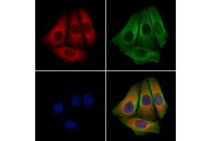 ABIN6257952 and ABIN6274275 staining Hela cells by IF/ICC. (BCAP31 antibody  (C-Term))