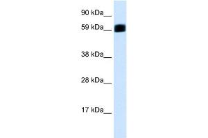 WB Suggested Anti-EIF2AK2 Antibody Titration:  0. (EIF2AK2 antibody  (C-Term))