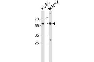 Western Blotting (WB) image for anti-Retinoic Acid Receptor, alpha (RARA) antibody (ABIN2997575)