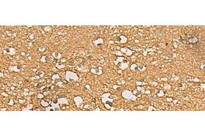 Immunohistochemistry of paraffin-embedded Human brain tissue using ENO3 Polyclonal Antibody at dilution of 1:70(x200) (ENO3 antibody)