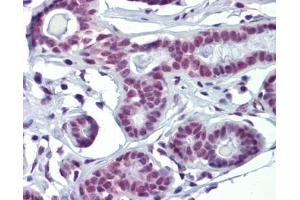 SOX4 antibody was used for immunohistochemistry at a concentration of 4-8 ug/ml. (SOX4 antibody  (N-Term))