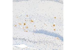Immunohistochemistry analysis of paraffin embedded mouse Alzheimer',s brain using Aβ40 (ABIN7073042) at dilution of 1:400 (180x lens) (Abeta 1-40 antibody)