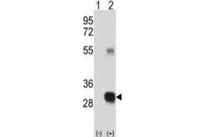 Western Blotting (WB) image for anti-CAAX Prenyl Protease 2 (RCE1) antibody (ABIN3001522) (RCE1/FACE2 antibody)