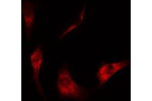 ABIN6274506 staining Hela cells by IF/ICC. (NT5C3 antibody  (N-Term))